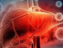 Dinkes Sulsel Waspadai Masuknya Hepatitis Misterius